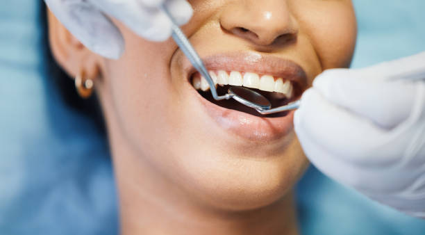 Best Emergency Tooth Extraction in Mesquite, TX